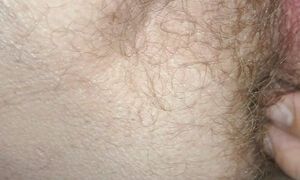 My Hairy